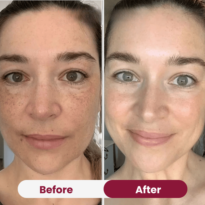 Máscara Dermavii - Bio Colágeno
